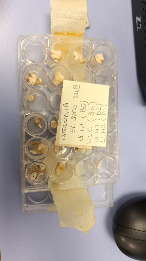 Dental samples.